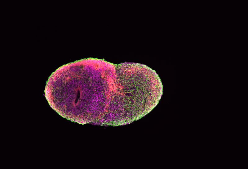 A brain organoid, photographed with greens, pinks, and magentas and suspended against a black background