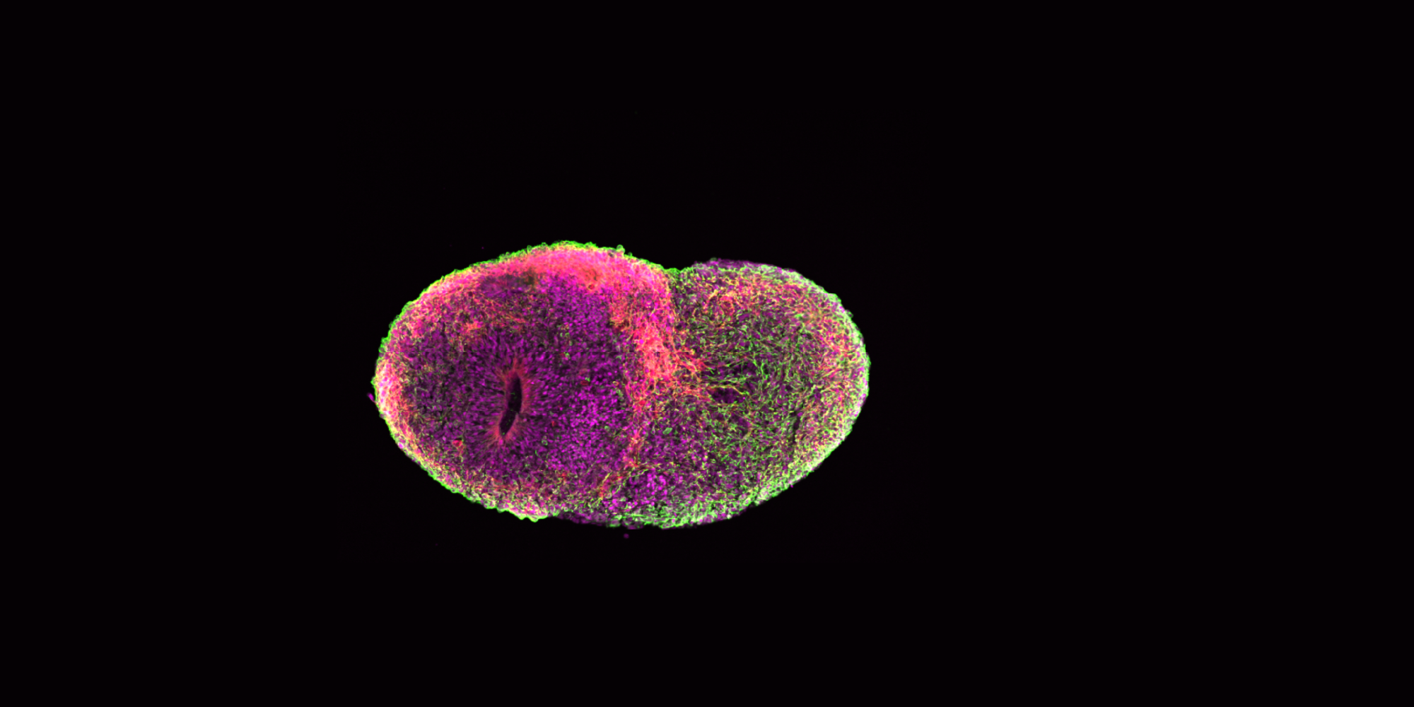 A brain organoid, photographed with greens, pinks, and magentas and suspended against a black background